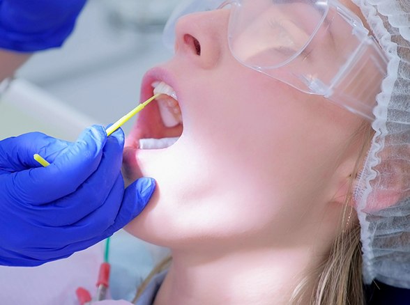 a pre-teen receiving fluoride treatment