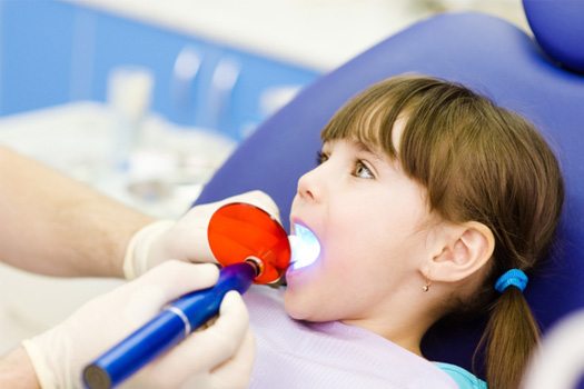 Dentist applying UV light to little girl’s dental filling