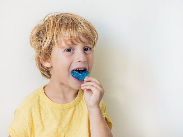 Child placing blue mouthguard in his mouth