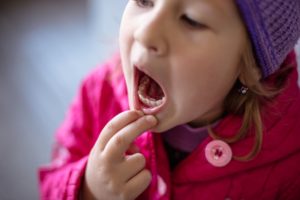 Little girl in pink jacket opening her mouth with two fingers to show an extra row of teeth